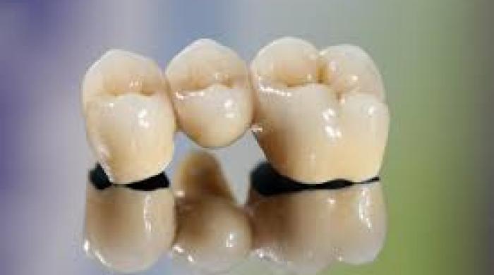 Prothésistes dentaires
